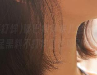 嘴巴疼得卷儿全开，某网红明星黑料不打烊直达吸引眼球！